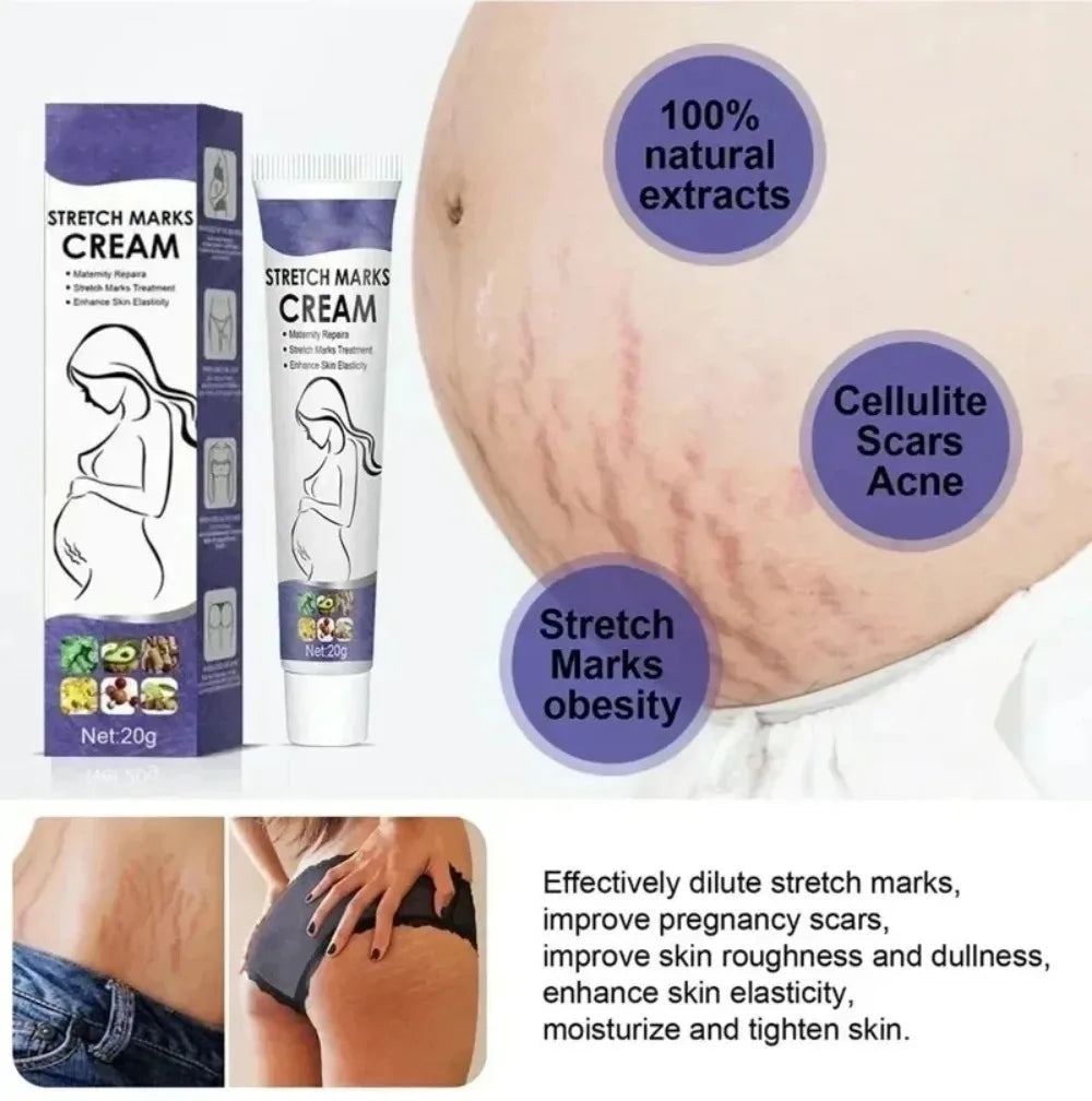 Stretch Marks Permanent Removal Cream Eliminate Body Belly Stretch Marks Swelling Marks Remove Skin Cracks Repair Firming Care Viralgem Store