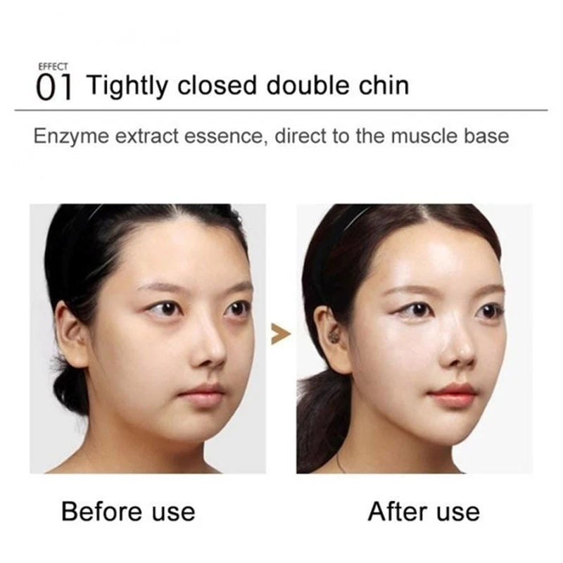 V-Shape Slimming Cream Firming Face-lift Slimming Removal Masseter Muscle Double Chin Face Fat Burning Anti-aging Products
