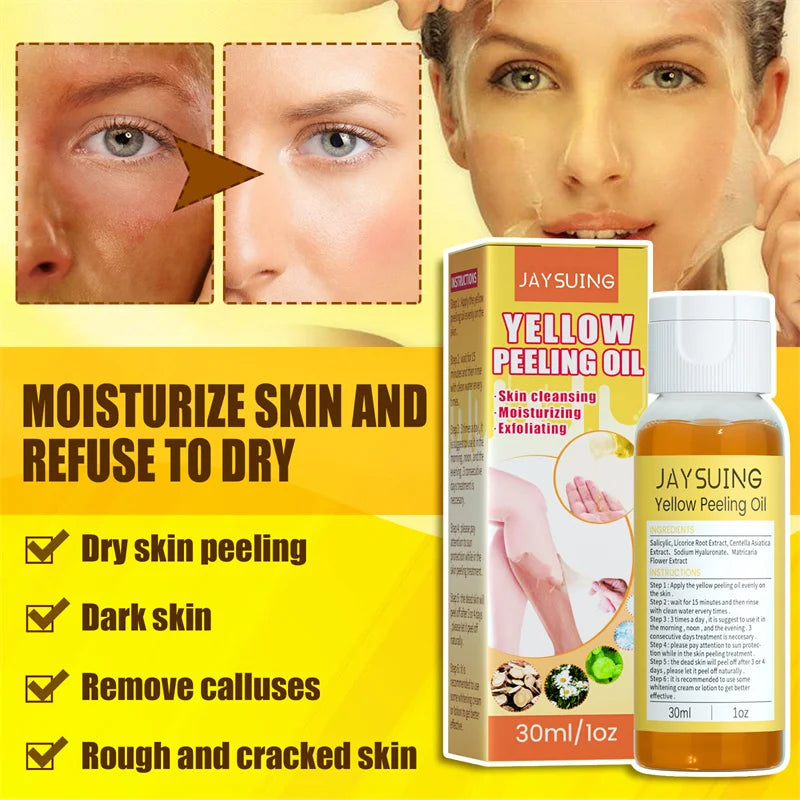 Yellow Peeling Oil Body Cleansing Exfoliation For Tender Glowing Skin Finger Joint Whitening Moisturizing Care Beauty Products