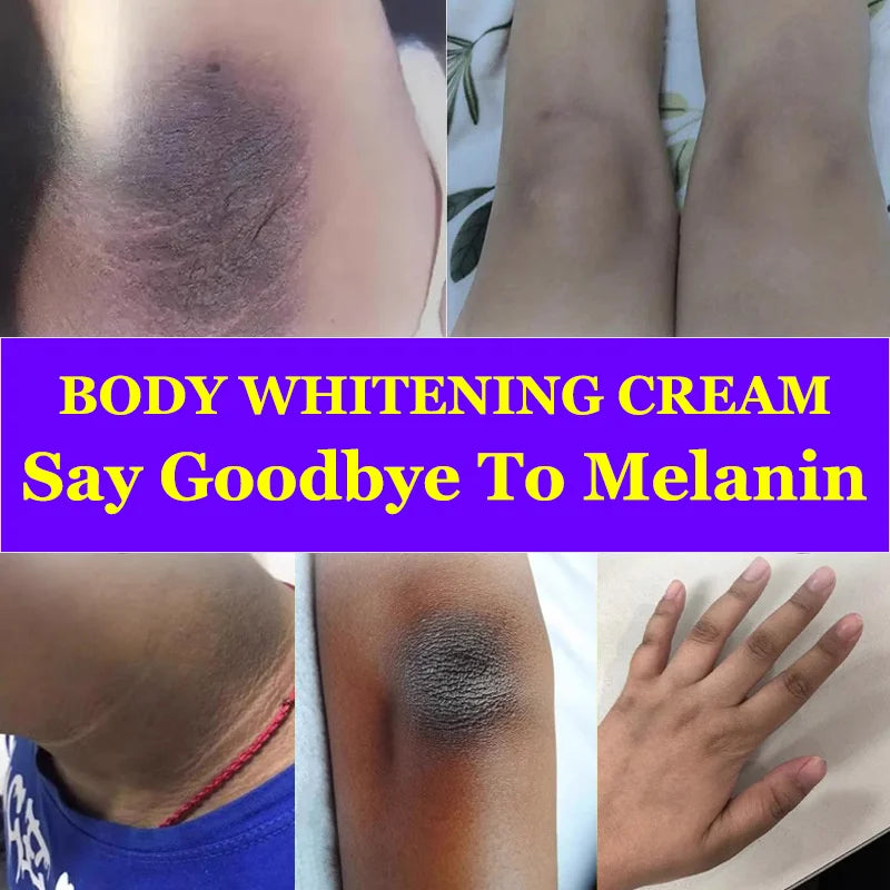 Whitening Cream Private Parts Underarm Bleaching Serum Whiten Butt Knee Brighten Inner Thigh Intimate Parts Dark Remove Melanin Viralgem Store