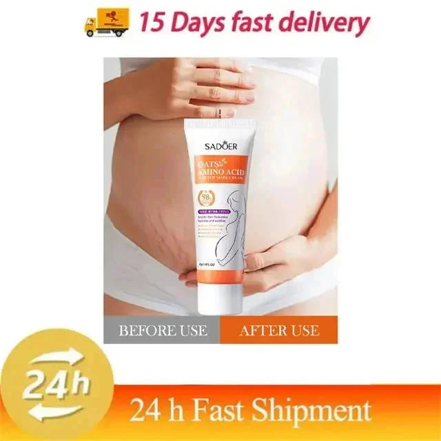 Stretch Marks Permanent Removal Cream Eliminate Body Belly Stretch Marks Swelling Marks Remove Skin Cracks Repair Firming Care Viralgem Store