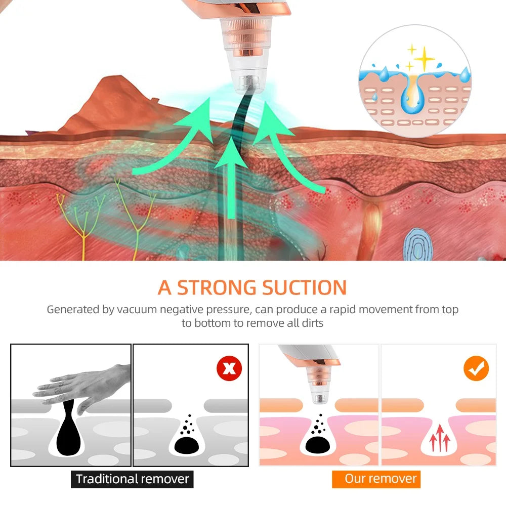 Vacuum Nose Blackhead Remover Face Cleansing Beauty Machine Facial Suction Cleaner Pimple Dead Skin Remover Extractor Skin Care Viralgem Store