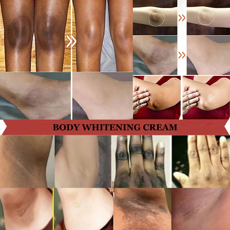Whitening Cream Private Parts Underarm Bleaching Serum Whiten Butt Knee Brighten Inner Thigh Intimate Parts Dark Remove Melanin Viralgem Store