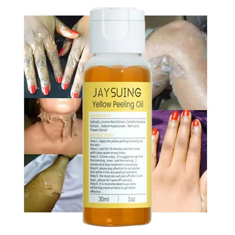 Yellow Peeling Oil Body Cleansing Exfoliation For Tender Glowing Skin Finger Joint Whitening Moisturizing Care Beauty Products