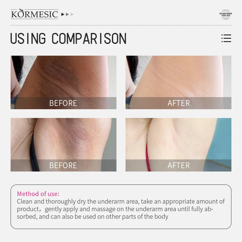 50g Body Underarm Whitening Cream Private Parts Bleaching Whiten Butt Knee Brighten Inner Thigh Intimate Dark Remove Melanin Viralgem Store