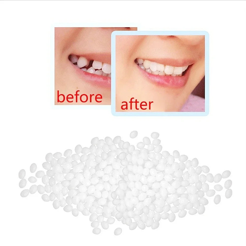 50g Resin Temporary Tooth Repair Granules Teeth Gaps Missing Broken Tooth Filling Moldable Adhesive Dentures False Teeth Tools Viralgem Store