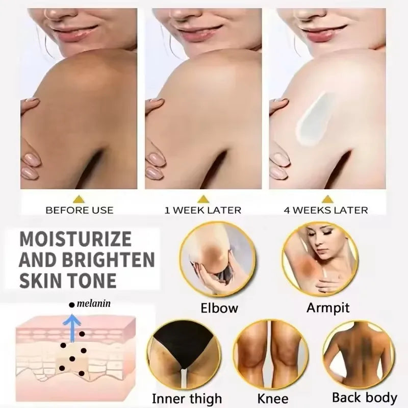 50g Body Underarm Whitening Cream Private Parts Bleaching Whiten Butt Knee Brighten Inner Thigh Intimate Dark Remove Melanin Viralgem Store