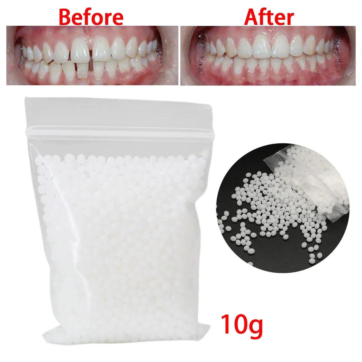 10G Temporary Tooth Solid Glue Fix Missing Broken Gaps Filling Viralgem Store