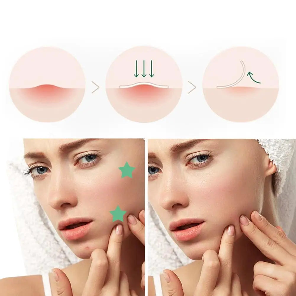 300/600pcs Invisible Acne Patch Reduce Pimples Blackheads Mild Non-irritating Concealer Face Spot Skin Care Tools Waterproof