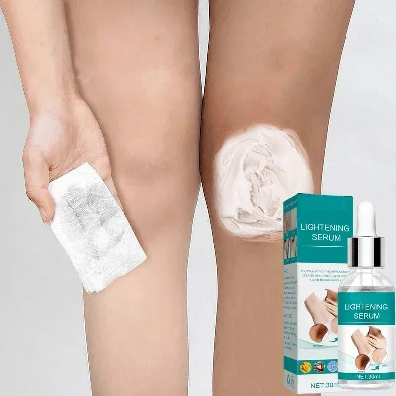 2025Dark knuckles whitening serum Elbows Armpit Beaching Serum Private parts whitening essence Lightens Elbows Knees Underarms Viralgem Store