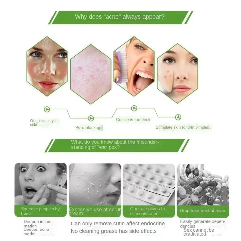 Top Natural Tea Tree Essential Oil For Remove Acne Beauty Skincare Skincare Homemade Perfume Meditation Aromatherapy 100ml/botle Viralgem Store