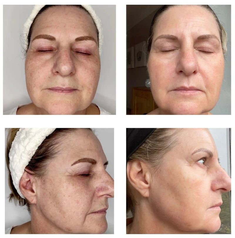 10pcs Sponge Microcrystal Freeze-dried Powder Collagen Regeneration Natural Biological Extract Sponge Spicules Skin Cell Renew Viralgem Store