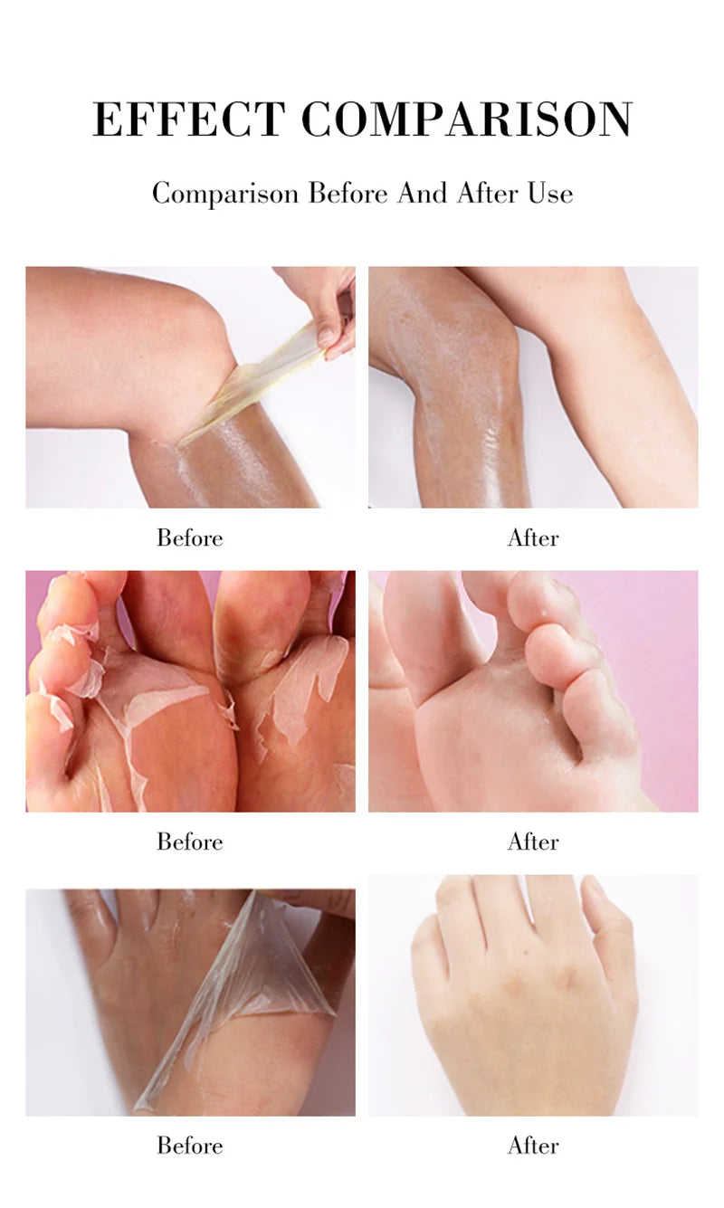 Yellow Peeling Oil Body Cleansing Exfoliation For Tender Glowing Skin Finger Joint Whitening Moisturizing Care Beauty Products