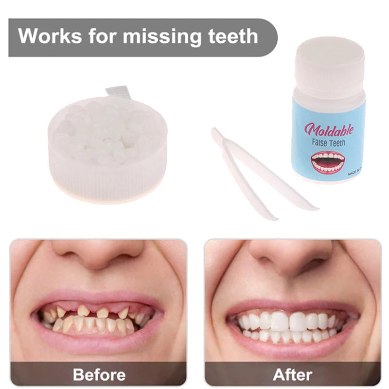 10g-30g Temporary Tooth Repair Kit Teeth And Gaps FalseTeeth Solid Glue Denture Adhesive Teeth Whitening Tooth Beauty Tool Viralgem Store