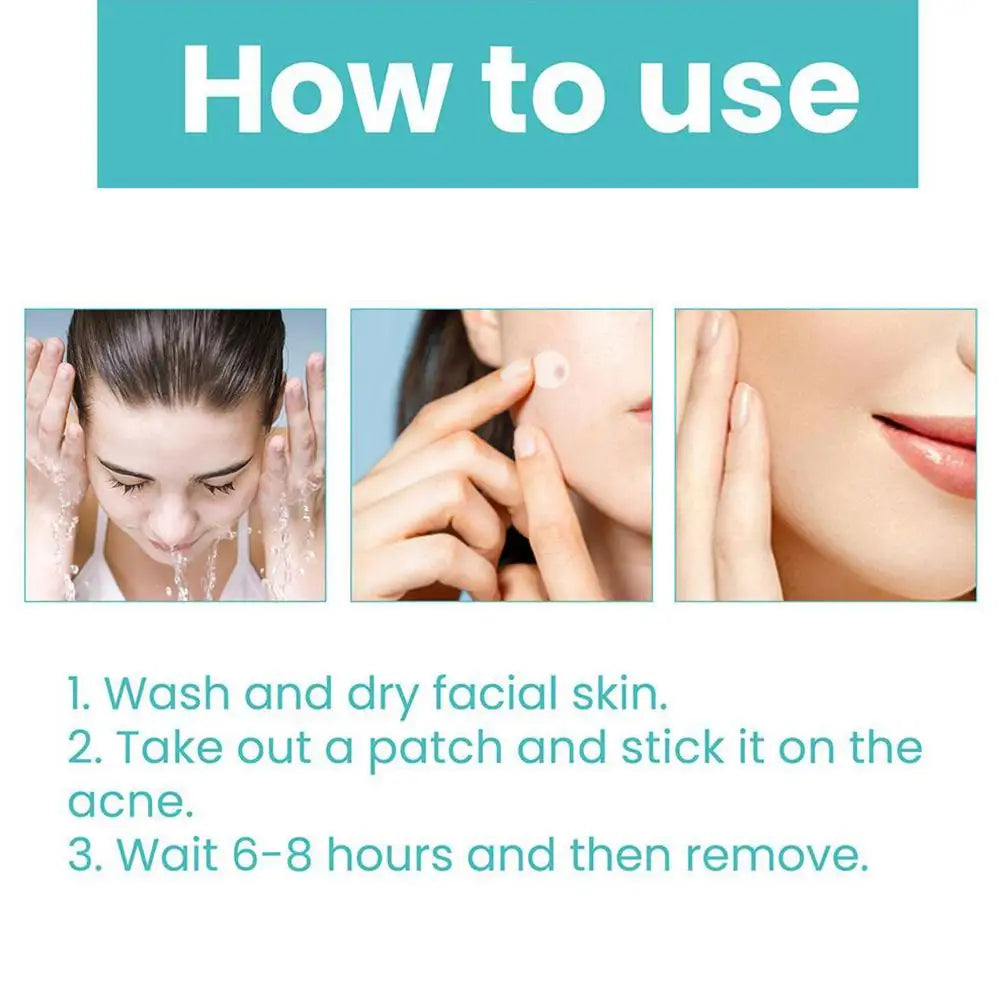 36 Patches Acne Pimple Patch Face Invisible Stickers Quick Effect Treatment Removing Patches Beauty Acne Tools Face Skin Care