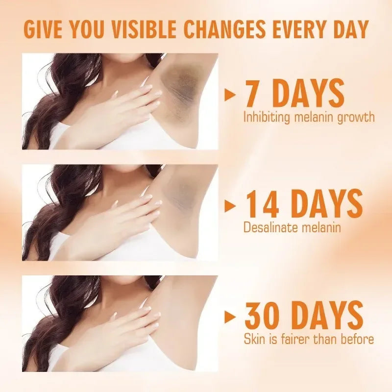 Vitamin C Brightening Cream Whitening Brightening Melanin Intimate Areas Bleaching Legs Knees Elbows Arms Bend Brighten Melanin