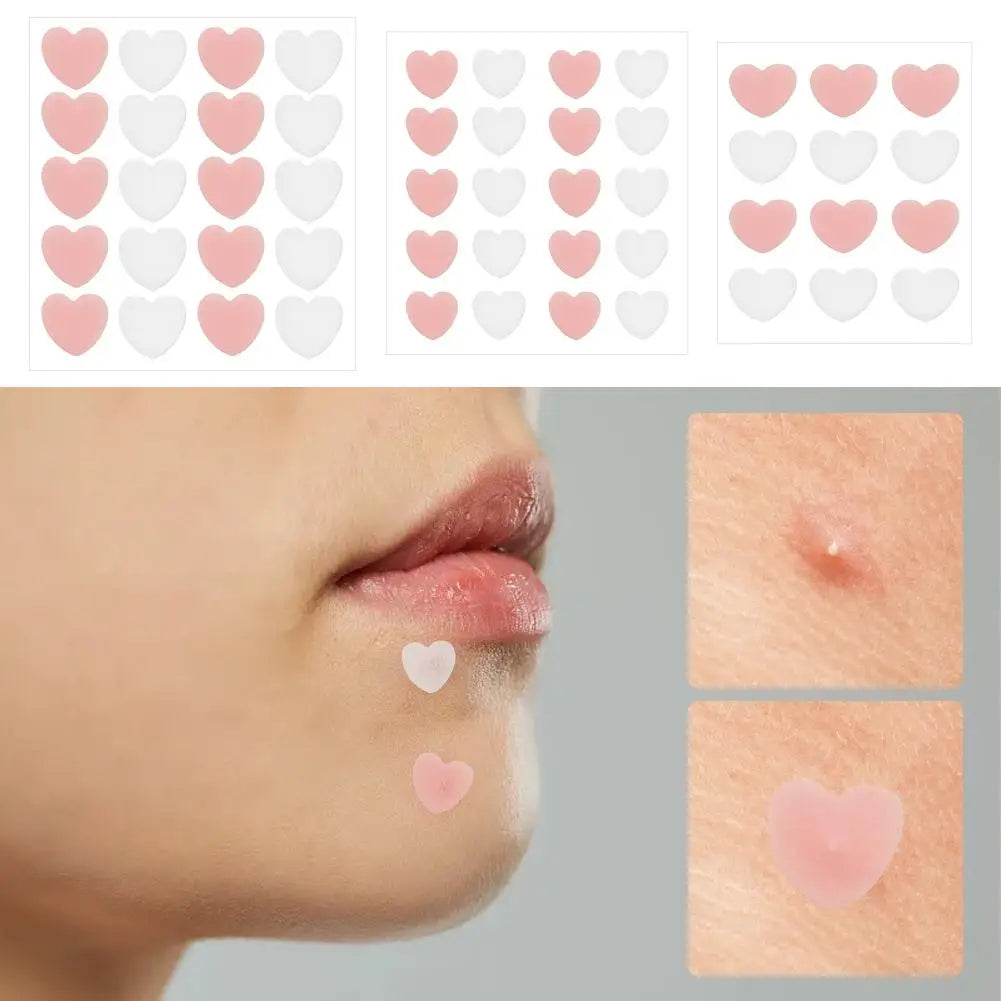12/20 Counts Acne Care Patches Cute Pink Heart Shaped Acne Pimple Patches Invisible Acne Cover Treatment Stickers Skin Care Viralgem Store
