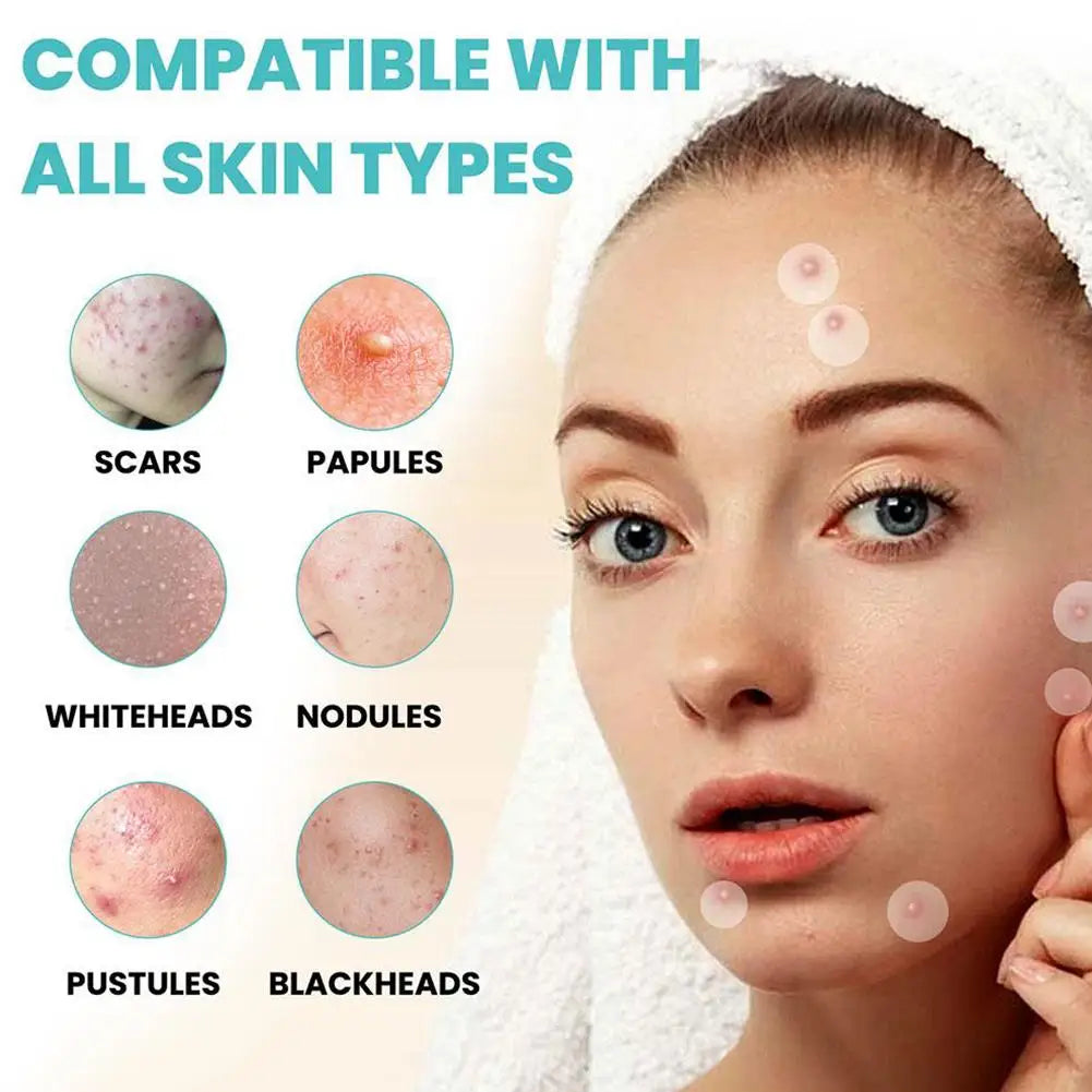 36 Patches Acne Pimple Patch Face Invisible Stickers Quick Effect Treatment Removing Patches Beauty Acne Tools Face Skin Care