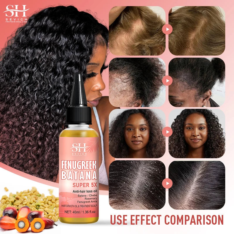 Super 5x Fenugreek Anti-Hair Loss Oil For Man Hair Treatment Fast Regrowth Thicken Oils Scalp Damaged  Repair Care Products Viralgem Store