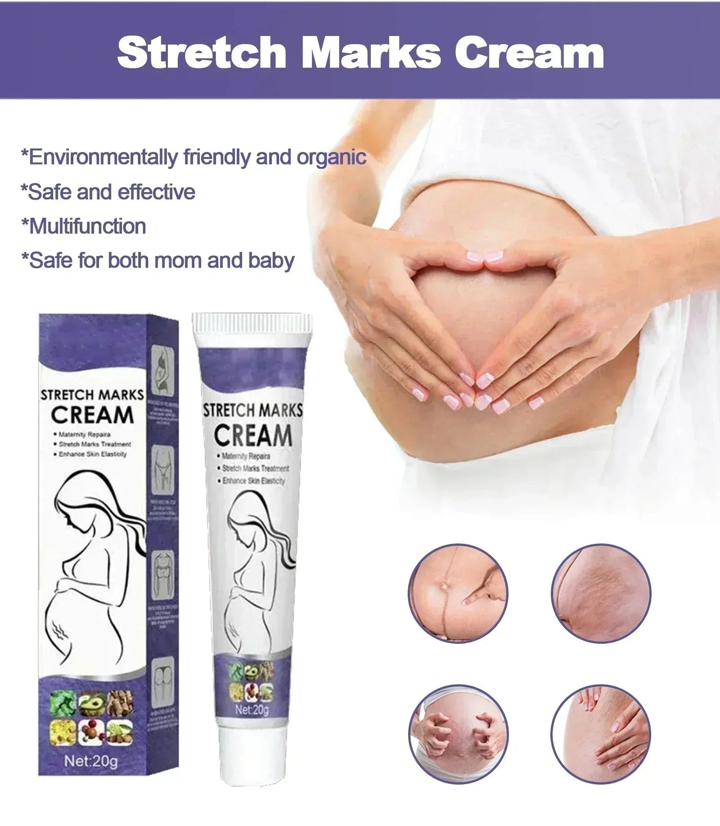 Stretch Marks Permanent Removal Cream Eliminate Body Belly Stretch Marks Swelling Marks Remove Skin Cracks Repair Firming Care Viralgem Store