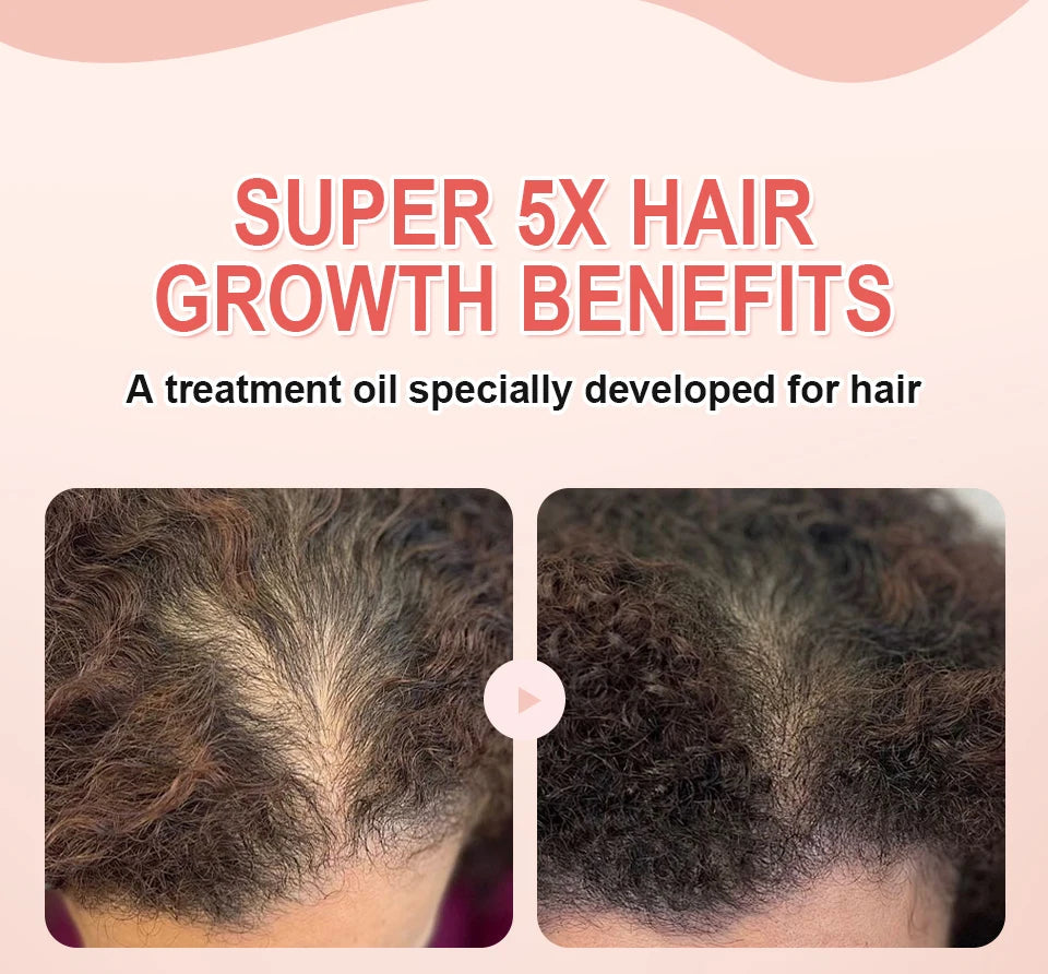 Super 5x Fenugreek Anti-Hair Loss Oil For Man Hair Treatment Fast Regrowth Thicken Oils Scalp Damaged  Repair Care Products Viralgem Store