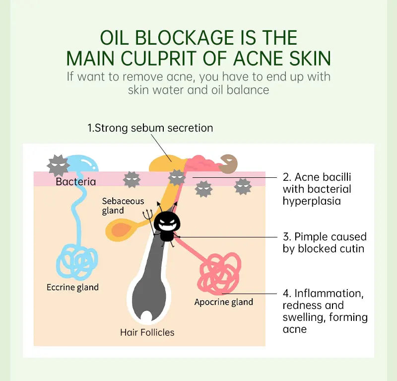 Tea Tree Acne Treatment Facial Serum Moisturizing Hyaluronic Acid Oil Control Pimple Removal Essence Face Serum Skin Care